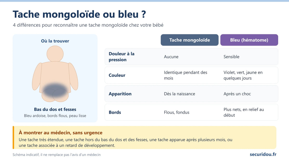 Infographie : 4 différences entre une tache mongoloïde et un bleu chez votre bébé (douleur, couleur, apparition, bords), avec la zone habituelle au bas du dos et sur les fesses